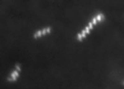 キイロショウジョウバエの体液中の共生細菌スピロプラズマの写真