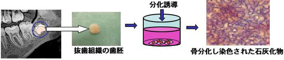 抜歯にて歯胚摘出し接着状態の間葉系幹細胞抽出し骨、肝臓、神経の分化誘導を行う概要図