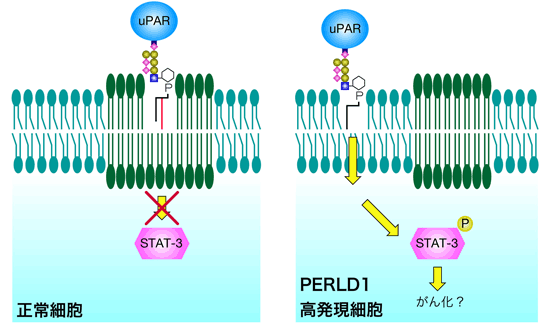 PERLD1高発現細胞の発がんモデルの図