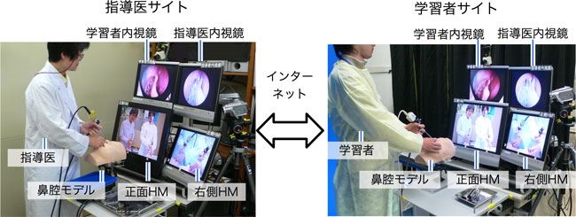 内視鏡下鼻内手術遠隔指導システムの写真