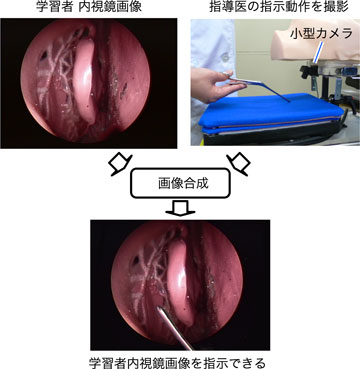 指導医による学習者内視鏡画像の指示の写真