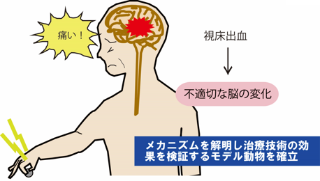 脳卒中後疼痛のメカニズムの解明や、治療効果の評価につながる可能性のあるモデル動物の図