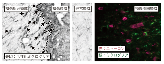 損傷周囲におけるミクログリアの活性化の図