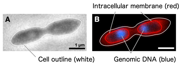 photo: Genomic DNA localized in RT761 strain cell