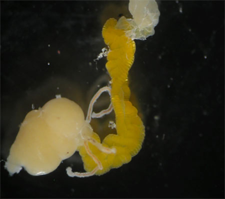 チャバネアオカメムシから摘出した消化管の後部の写真