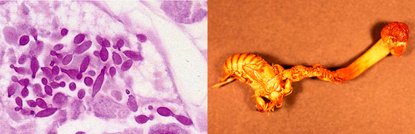 ササマルアブラムシ体内の共生真菌（上）と冬虫夏草のオオセミタケ（下）の写真