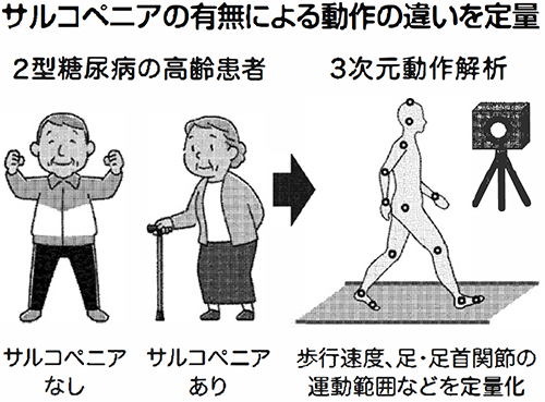 サルコペニアの有無による動作の違いを表した概要図