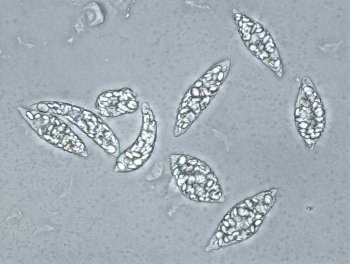 パラミロンを蓄積したミドリムシの写真