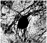 前脳基底野コリン作動性神経細胞に対する変異型BDNFの効果：コントロールの画像