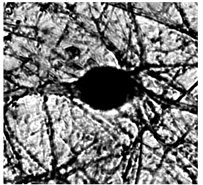 前脳基底野コリン作動性神経細胞に対する変異型BDNFの効果：正常型BDNFの画像