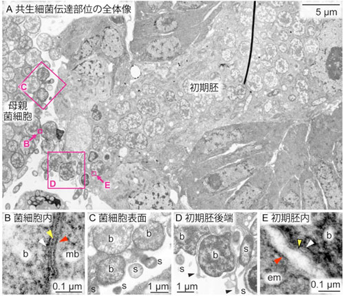 共生細菌伝達部位の電子顕微鏡観察画像