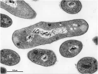 ロドコッカス属細菌（Rhodococcus erythropolis）の透過型電子顕微鏡写真