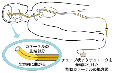 高分子アクチュエーターの能動カテーテルへの応用の図