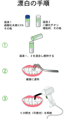 漂白の手順の図