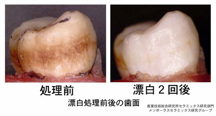 漂白処理前後の歯面の写真