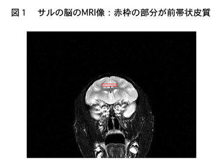 図1　サルの脳のMRI像：赤枠の部分が前帯状皮質