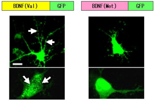 ValあるいはMetのSNPをもったBDNFとGFPの融合蛋白質の発現パターンの違いの図