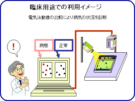 高速全自動タンパク質二次元電気泳動システムの臨床用途イメージ図