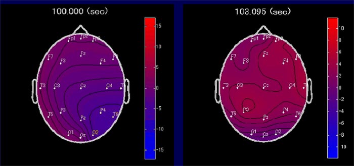 α波の頭皮上電位分布の図