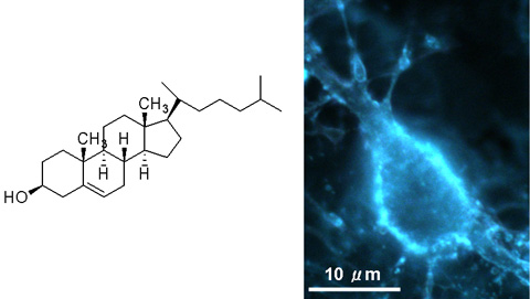 コレステロールの分子構造とコレステロール結合色素による神経細胞の蛍光染色写真