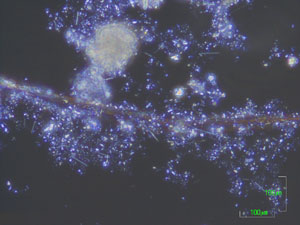 溶融処理前のクリソタイルの位相差顕微鏡写真