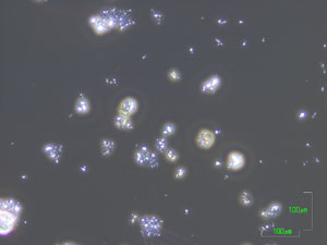 溶融処理後のクリソタイルの位相差顕微鏡写真