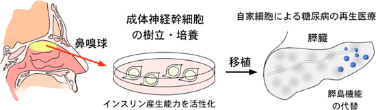 自家細胞による糖尿病の再生医療の概念図