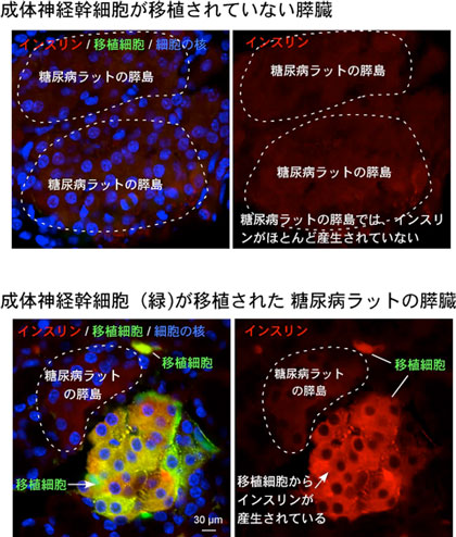 移植された成体神経幹細胞がインスリンを産生している様子の図