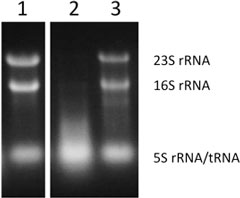 細胞内RNA分解を指標としたRNase T2阻害活性の評価の図