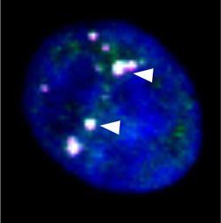 核内構造体であるパラスペックル（白矢印部分）の画像