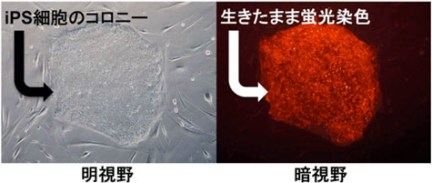 生きたまま染色したiPS細胞の光学顕微鏡像写真