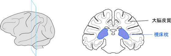 脳における視床枕の位置の図