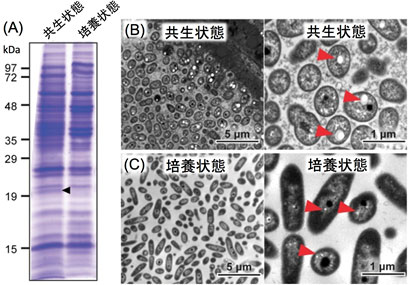 共生状態と培養状態の共生細菌に含まれるタンパク質の比較画像、 共生状態の共生細菌の電子顕微鏡像、培養状態の共生細菌の電子顕微鏡像