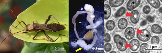 ホソヘリカメムシの消化管の後端部と、細胞内PHA顆粒を蓄積した共生細菌の写真