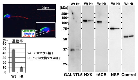 遺伝子改変マウスの精子で観察されるさまざまなタンパク質の異常の図