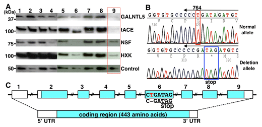 精子無力症におけるヒトGALNTL5遺伝子変異発症例の図