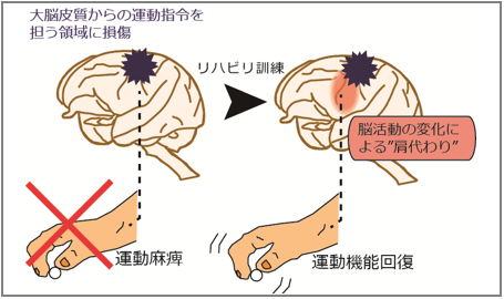 運動指令を担う領域の損傷後、把握動作を用いたリハビリにより手の運動機能が回復した。このとき残存する脳領域で損傷した領域の機能を肩代わりする脳活動の変化が生じていた図