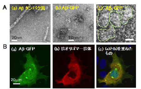 生体内・生体外でのAβ−GFPの様子