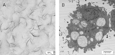 半導体型分離単層CNTの調製液、および24時間暴露したラットマクロファージ細胞の図
