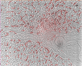 SWCNTの蛍光を赤色に変換した、褐色脂肪組織の近赤外蛍光顕微鏡写真