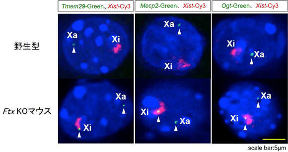 図3Ｘ染色体不活性化の異常写真