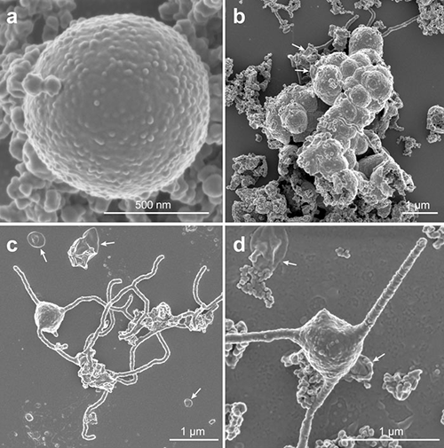 Figure: Scanning electron micrographs of cultivated archaeon (MK-D1 strain)