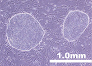 IPS細胞の写真