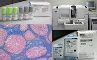 肝線維化が進む組織の顕微鏡画像と糖鎖マーカーを使った試験機の画像